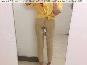 女人两腿之间变黑的原因？女人两腿之间变黑的原因？揭秘女人两腿之间变黑的原因